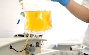 Blood bag used with PLEX therapy for treating cancer
